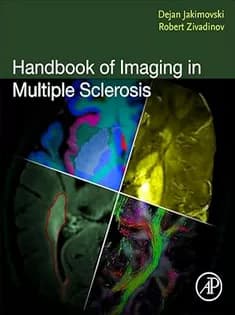 دانلود کتاب Handbook of Imaging in Multiple Sclerosis