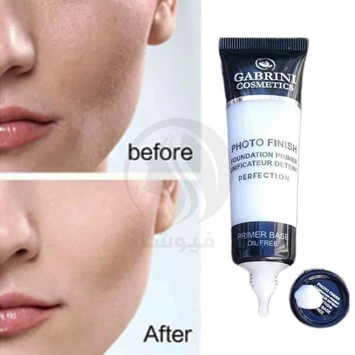 پرایمر گابرینی (Gabrini Primer) — تصویر ۲
