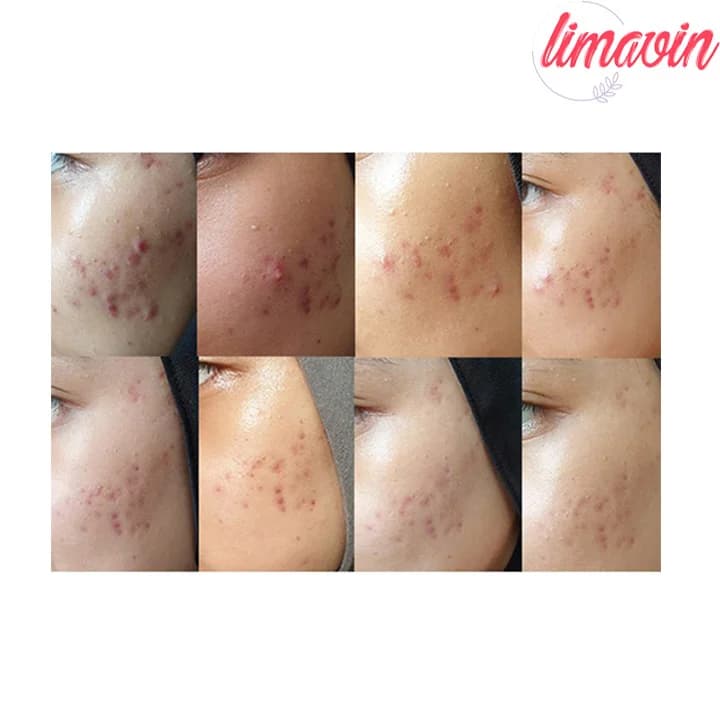 آمپول ضدجوش و تقویت کننده سد پوستی آرتیشو اکسیس وای حجم 30 میلی لیتر — تصویر ۵