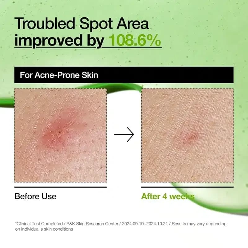سرم تسکین دهنده و ضدالتهاب آزلائیک اسید و هیالورون آنوا Anua مدل Redness Soothing Serum(30 میل) — تصویر ۳