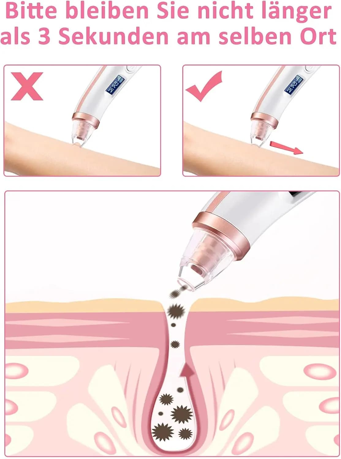 میکرودرم (پاک‌کننده جوش‌های سرسیاه و منافذ پوست) با مکش الکتریکی CANTIK کد 26079 — تصویر ۶