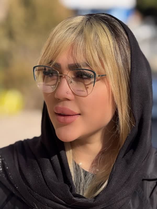 عینک طبی برند شنل مدل CH388 — تصویر ۳