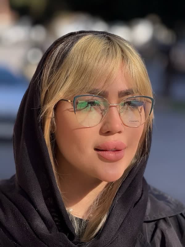 عینک طبی برند شنل مدل CH388 — تصویر ۲