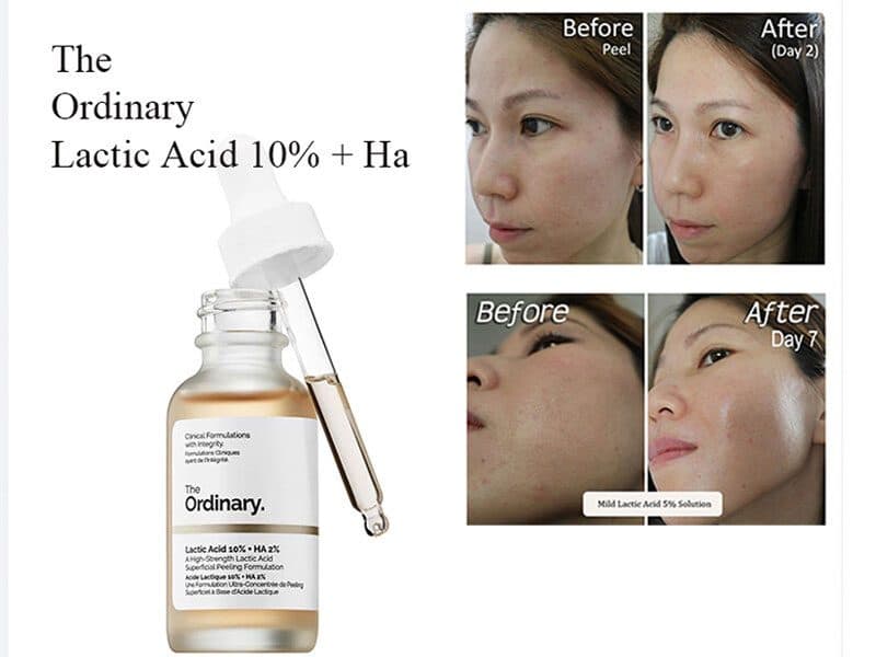 سرم لاکتیک اسید روشن کننده جوانساز و لایهبردار اسید لاکتیک 5% + HA — تصویر ۳