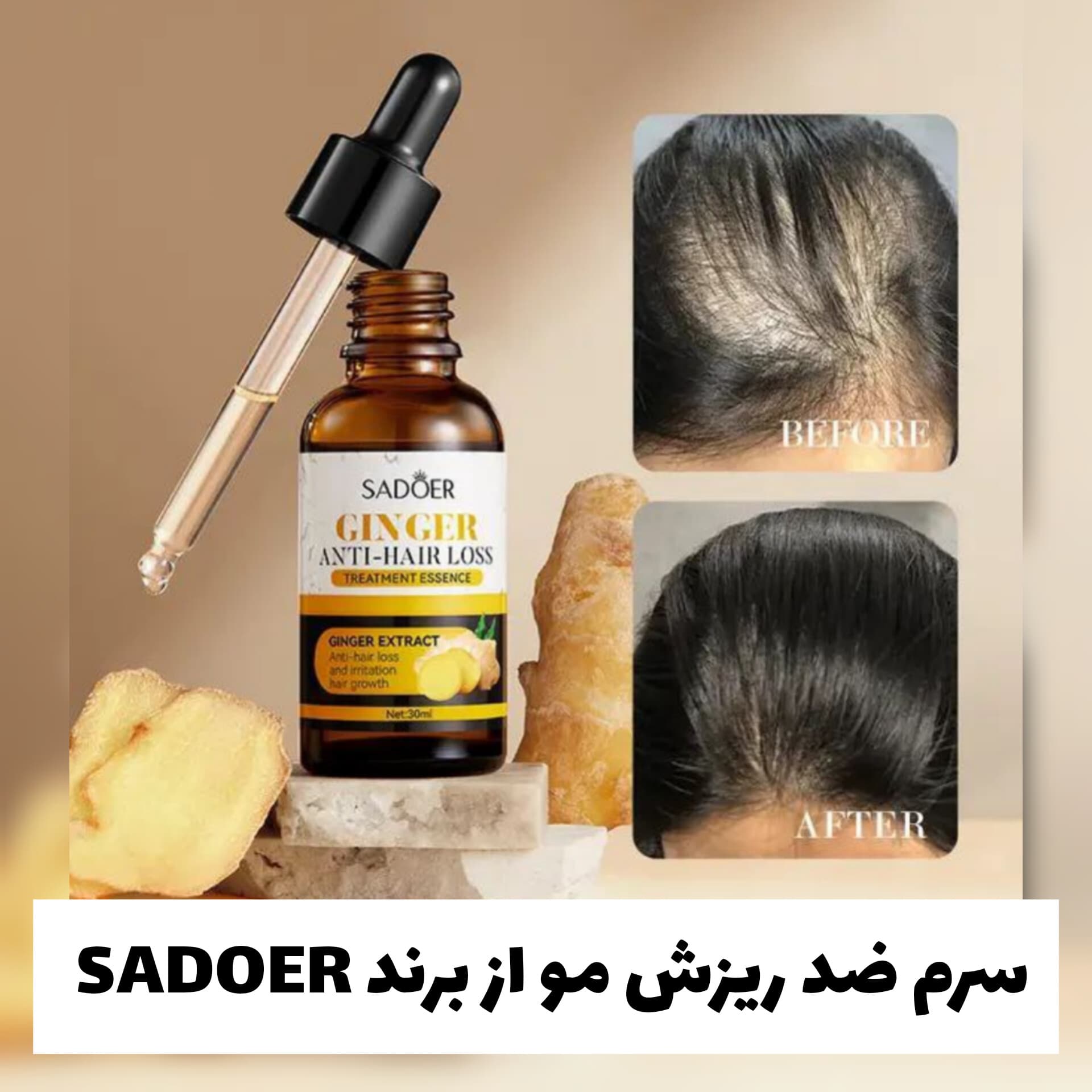 سرم ضد ریزش مو از برند سادور Sadoer