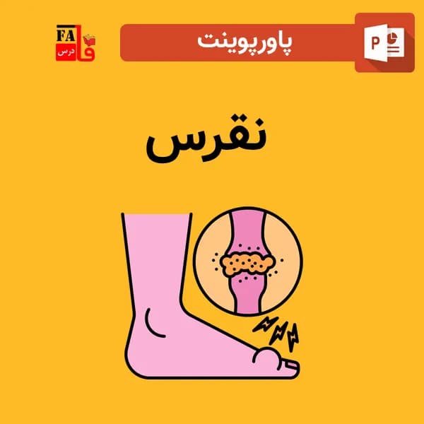 پاورپوینت نقرس — تصویر ۲