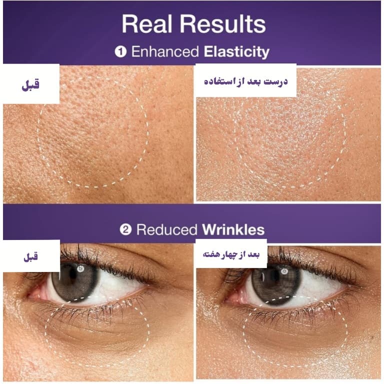 سرم پوست نامبوزین NUMBUZIN NAD+ BIO LIFTING-SIL ESSENCE حجم50ml اصل — تصویر ۶