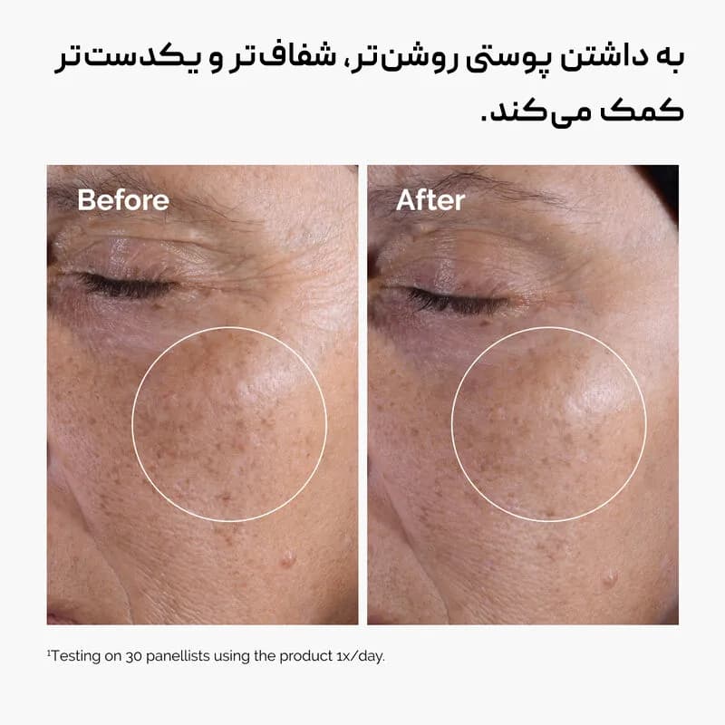تونر گلیکولیک اسید اوردینری The Ordinary — تصویر ۷