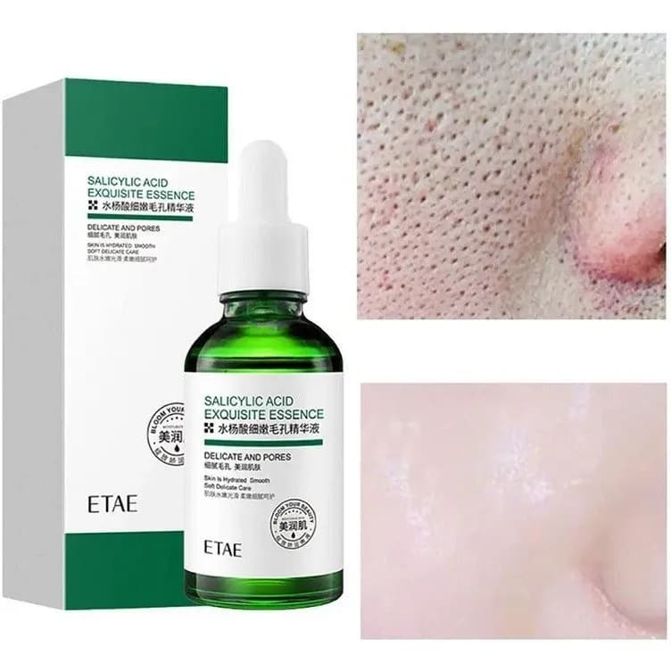 سرم ضد جوش وز مدل Salicylic Acid حجم 30 میلی لیتر — تصویر ۲