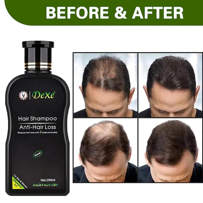 شامپو ضد ریزش مو دکسی DEXE — تصویر ۵