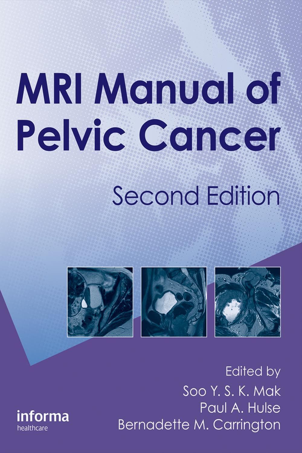 راهنمای ام‌آر‌آی سرطان لگن ۲۰۱۶ <br> MRI Manual of Pelvic Cancer 2016
