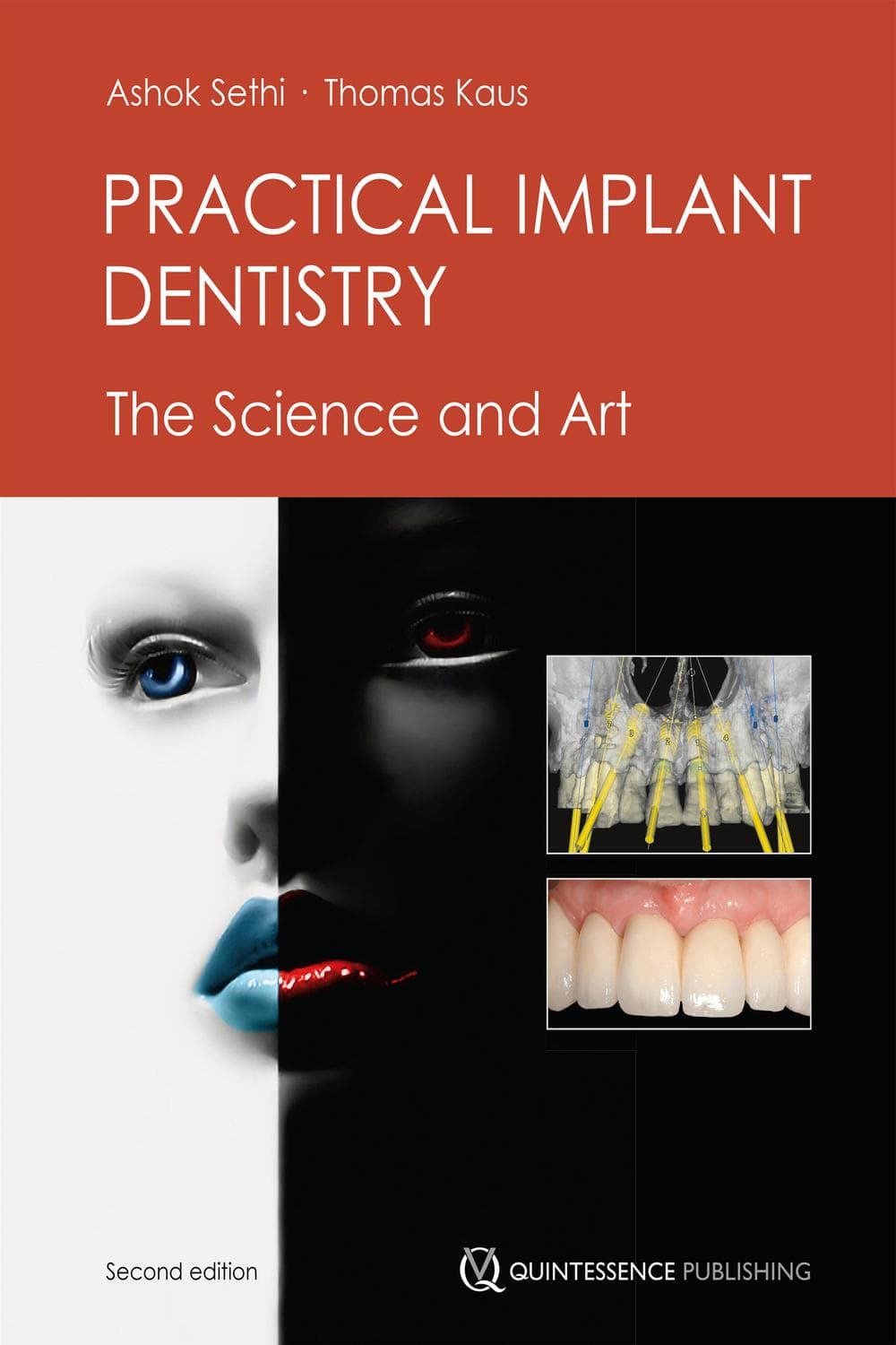 ایمپلنت دندانپزشکی کاربردی ۲۰۱۹ <br> Practical Implant Dentistry 2019 — تصویر ۲