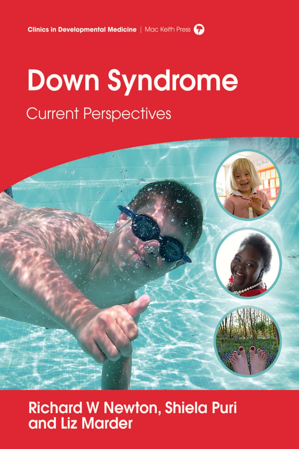 سندرم داون ۲۰۱۵ <br> Down Syndrome 2015