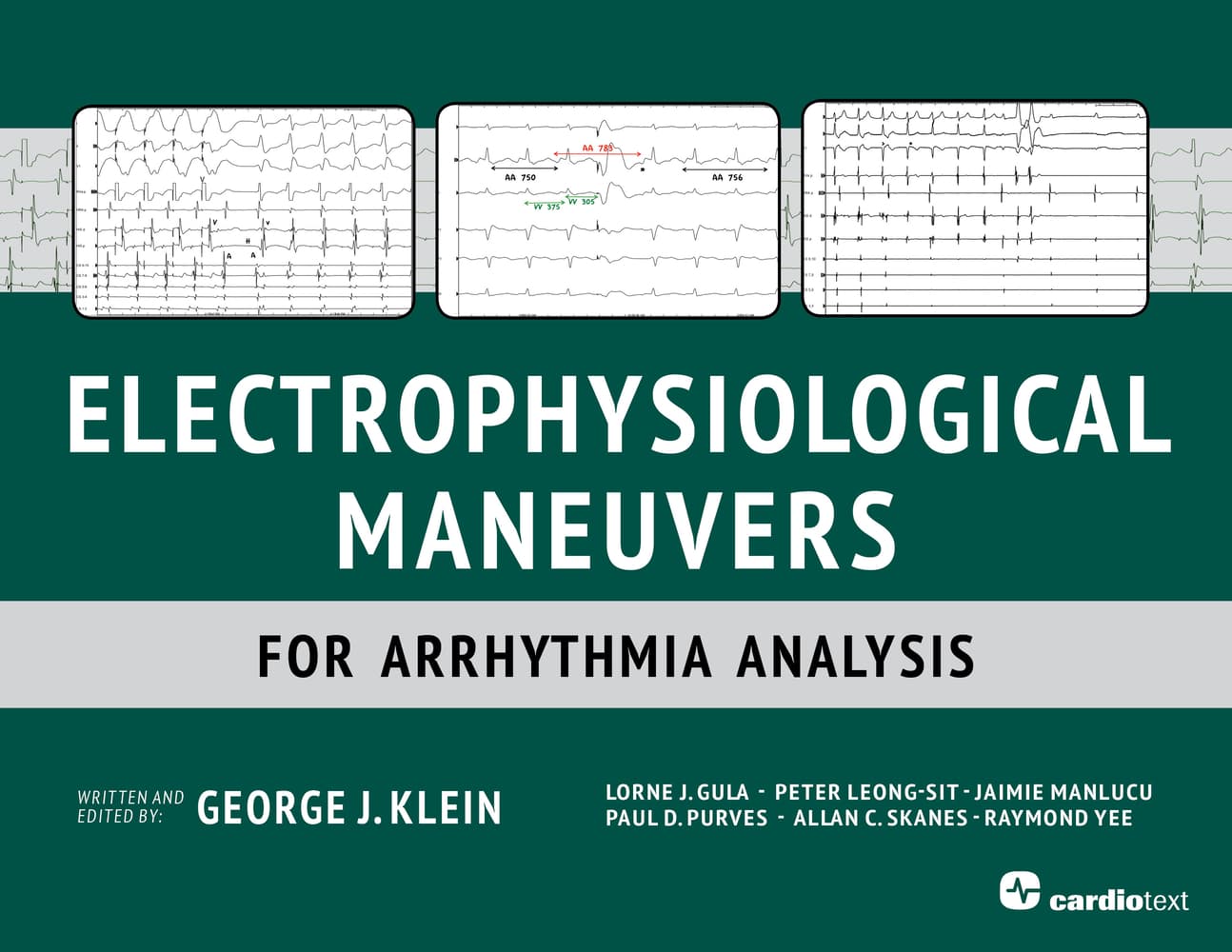 مانورهای الکتروفیزیولوژیک برای تحلیل آریتمی ۲۰۱۴ <br> Electrophysiological Maneuvers for Arrhythmia Analysis 2014 — تصویر ۲