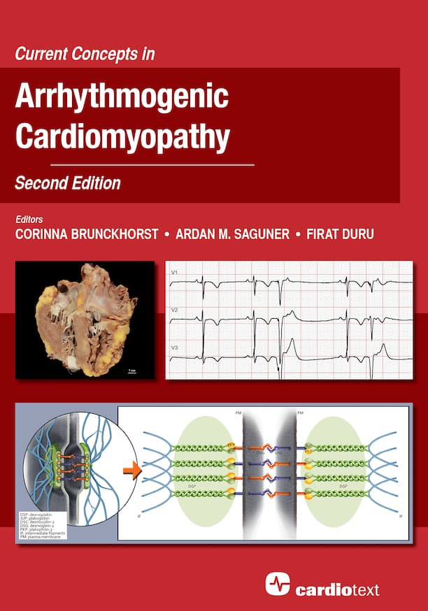 مفاهیم نوین در کاردیومیوپاتی آریتموژنیک، ویرایش دوم ۲۰۲۱ <br> Current Concepts in Arrhythmogenic Cardiomyopathy, Second Edition 2021