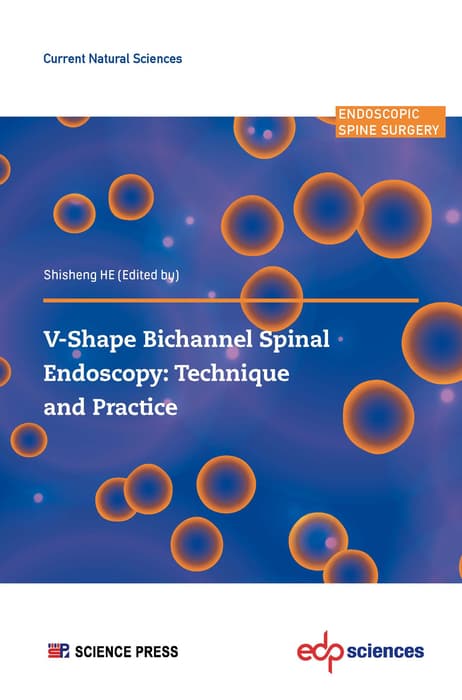اندوسکوپی ستون فقرات دوکاناله V شکل: تکنیک و عمل ۲۰۲۳ <br> V-shape Bichannel Spinal Endoscopy: Technique and Practice 2023