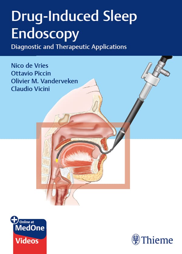 اندوسکوپی خواب ناشی از دارو ۲۰۲۰ <br> Drug-Induced Sleep Endoscopy 2020 — تصویر ۲