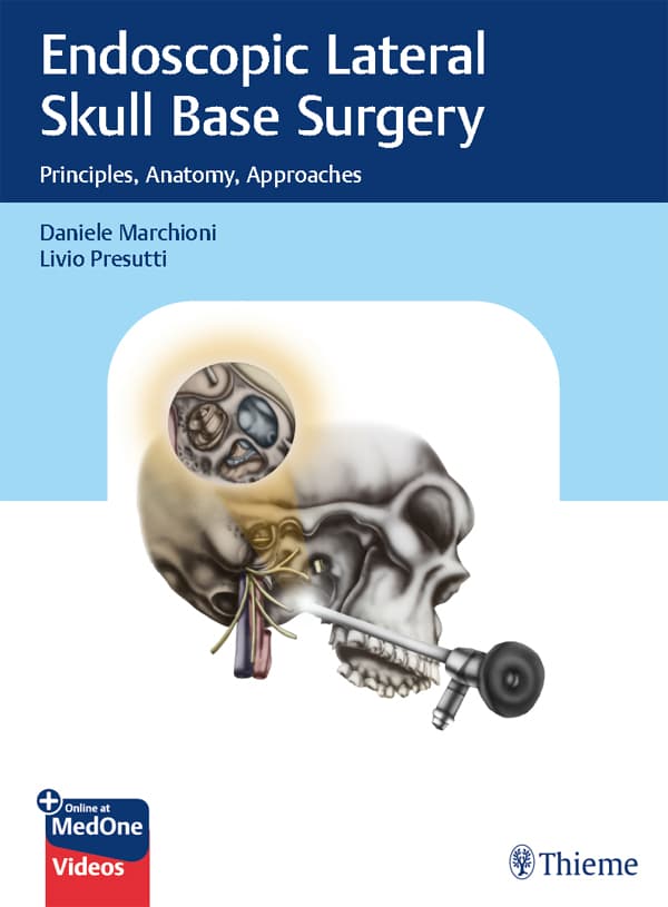 جراحی اندوسکوپیک قاعده جمجمه لترال ۲۰۲۲ <br> Endoscopic Lateral Skull Base Surgery 2022