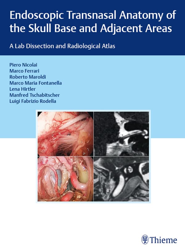 آناتومی اندوسکوپیک ترانسنازال قاعده جمجمه و نواحی مجاور ۲۰۱۹ <br> Endoscopic Transnasal Anatomy of the Skull Base and Adjacent Areas 2019