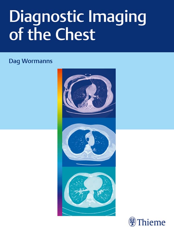 تصویربرداری تشخیصی قفسه سینه ۲۰۱۹ <br> Diagnostic Imaging of the Chest 2019