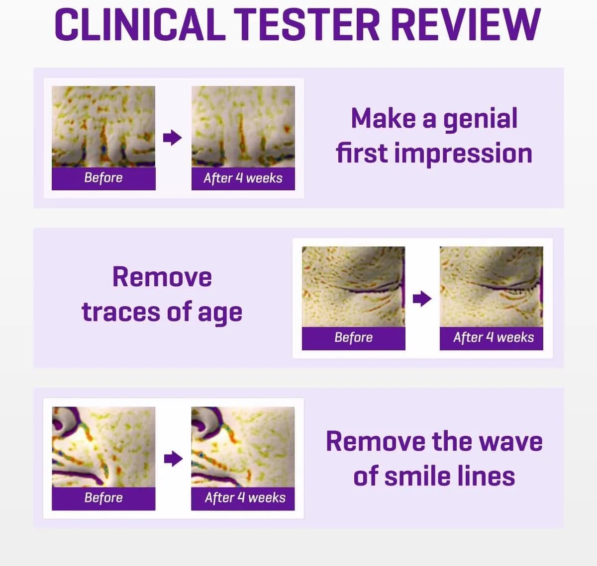 کرم دور چشم رتینول سام بای می Some By Mi – مدل Retinol Intense – ضد چروک و تیرگی | حجم 30 میل — تصویر ۵