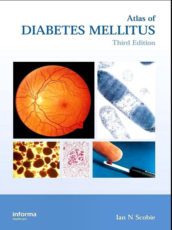 دانلود کتاب atlas de diabetes mellitus