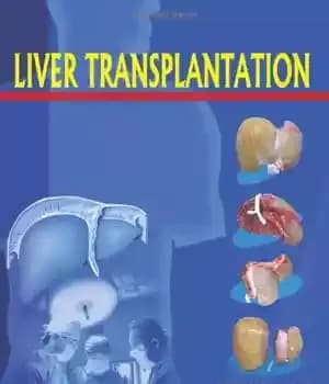 دانلود کتاب Liver Transplantation – پیوند کبد — تصویر ۲