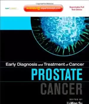 دانلود کتاب Early Diagnosis and Treatment of Cancer Series: Prostate Cancer: Expert Consult – Online and Print, 1e – تشخیص…