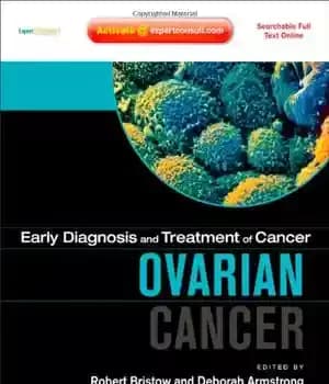 دانلود کتاب Ovarian Cancer with Expert Consult – سرطان تخمدان با مشاوره متخصص