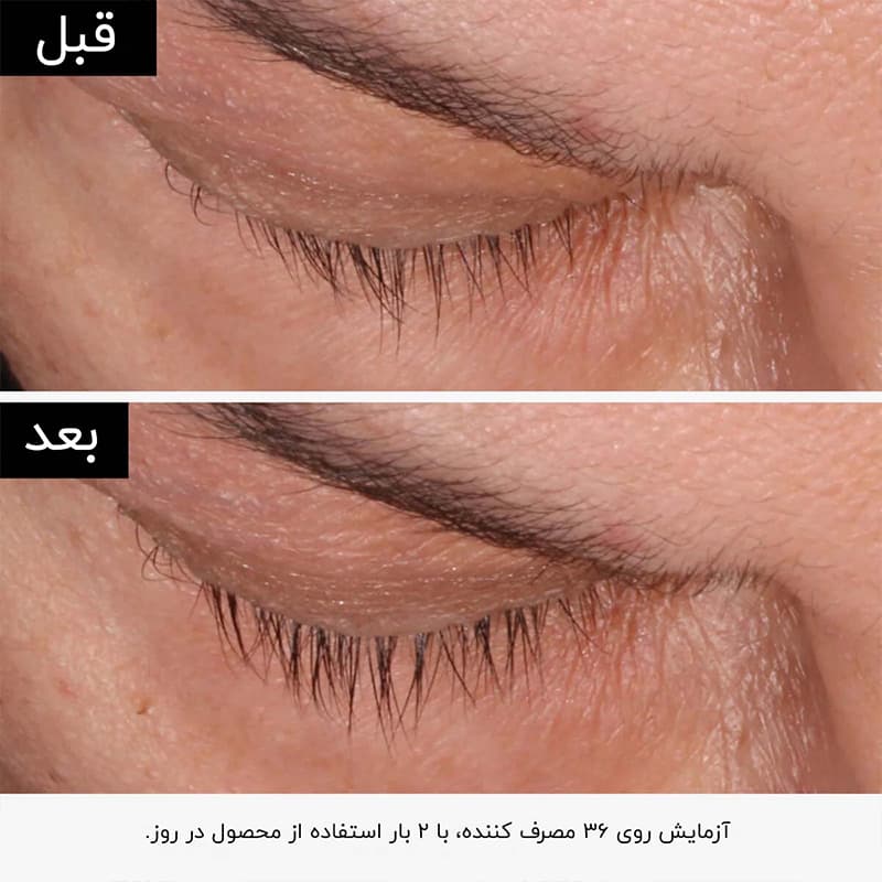 سرم تقویت کننده مژه و ابرو Multi Peptide اوردینری 5 میل — تصویر ۴