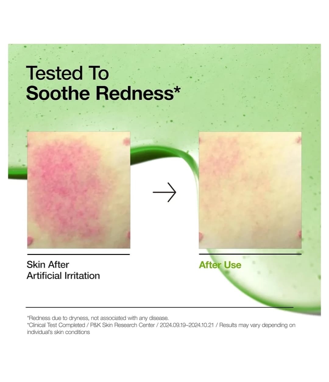 سرم آزلائیک اسید و هیالورون آنوا ANUA Azelaic Acid 10 Hyaluron — تصویر ۸