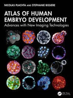 دانلود کتاب Atlas of Human Embryo Development Advances with New Imaging Technologies
