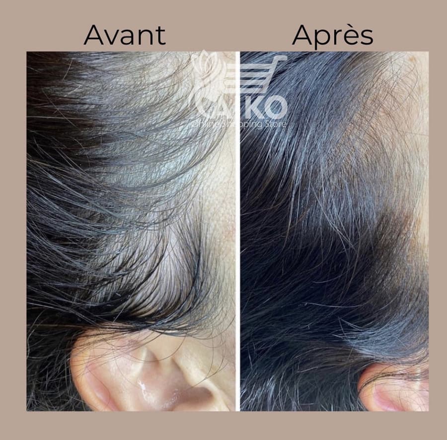 کوکتل مزولایک مو هیرپلاس +MesoLike Hair — تصویر ۸