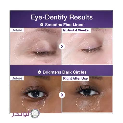 کرم دور چشم +NAD و رتینول شماره 9 نامبوزین ضد چروک و روشن کننده NUMBUZIN No.9 NAD+ Retinol Volumetox Eye Cream — تصویر ۱۰