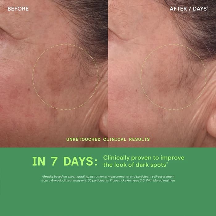 سرم ضد لک دکتر مورد Rapid Dark Spot Correcting — تصویر ۲