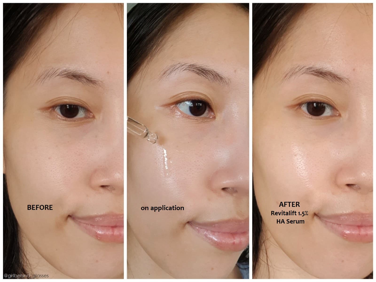 سرم ضد چروک و آبرسان لورال مدل Loreal Revitalift Filler — تصویر ۲
