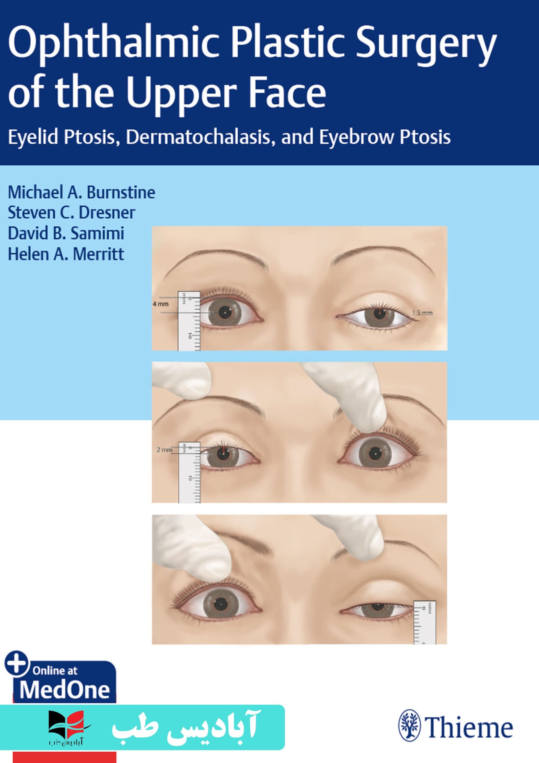 Ophthalmic Plastic Surgery of the Upper Face: Eyelid Ptosis, Dermatochalasis, and Eyebrow Ptosis | جراحی پلاستیک چشم ناحیه فوقانی صورت: پتوز پلک، درماتوشالازی و پتوز ابرو