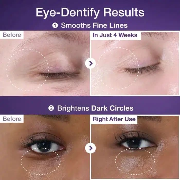 کرم دور چشم ضدچروک +NAD و رتینول numbuzin مدل 9+ NAD+ Retinol Volumetox Eye Cream(10 میل) — تصویر ۴