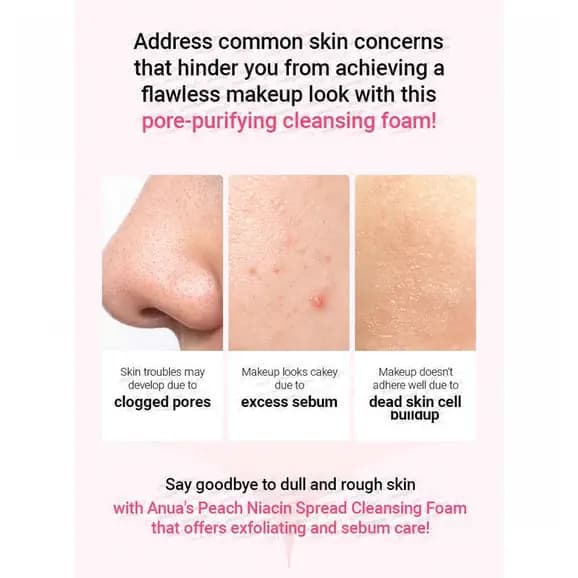 فوم پاک کننده هلو و نیاسین آنوا 150 میل | Anua Peach Niacin Spread Cleansing Foam — تصویر ۳