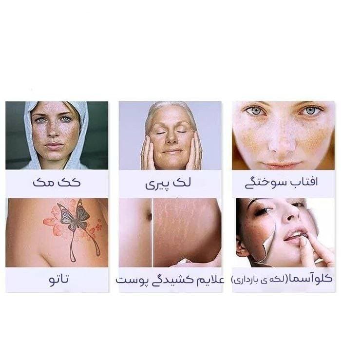 دستگاه لیزر دو کاره دایود پیکوشور حذف تتو و موهای زائد2022 — تصویر ۴