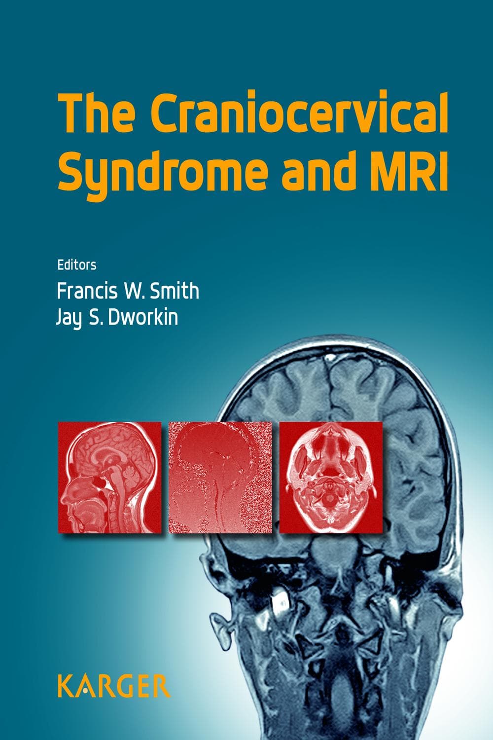 سندرم کرانیوسرویکال و ام‌آر‌آی ۲۰۱۵ <br> The Craniocervical Syndrome and MRI 2015