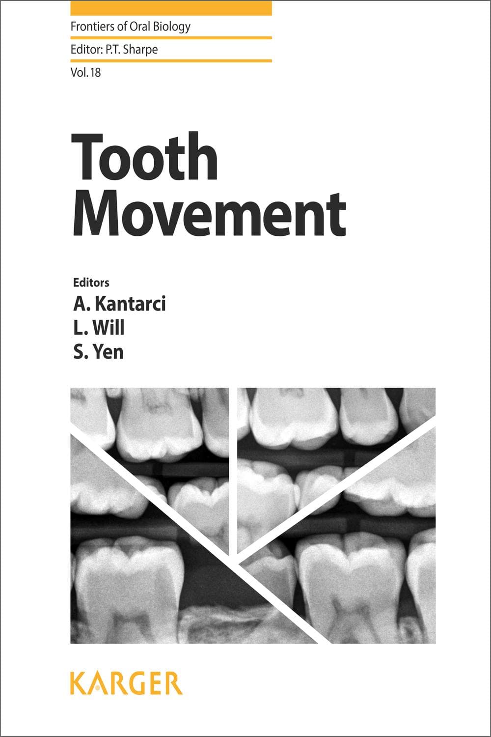 حرکت دندان ۲۰۱۵ <br> Tooth Movement 2015