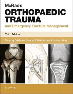 دانلود کتاب Essential of knee arthroplasty