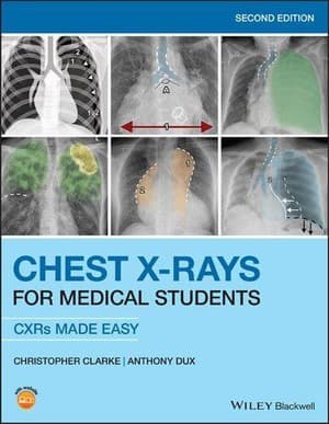 دانلود کتاب Chest X Rays For Medical Students CXRs Made Easy, 2nd Edition — تصویر ۲