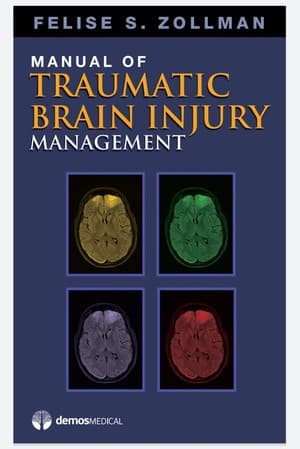 دانلود کتاب TBI Managemnt