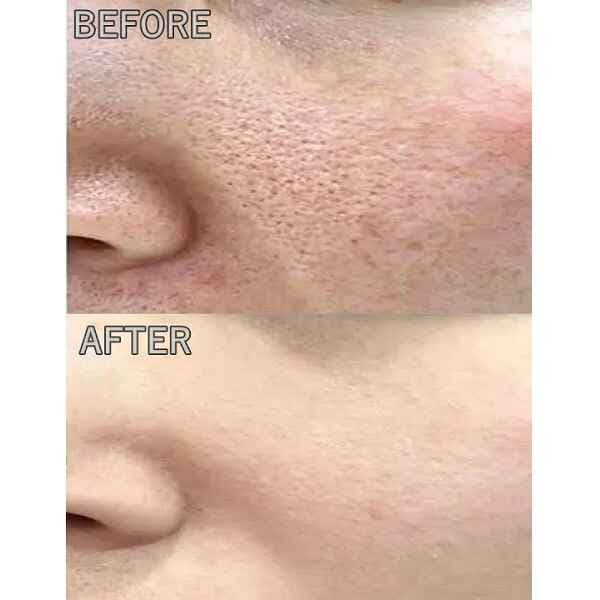 سرم کوچک کننده منافذ سام بای می SOME BY MI مدل سوپر ماچا SUPER MATCHA حجم 50 میل — تصویر ۲