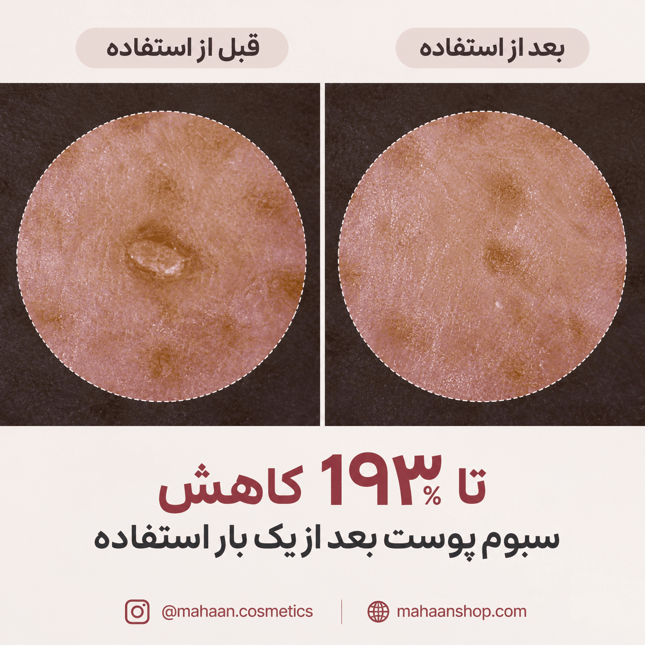 آمپول لایه بردار پیل شات برنج سفید دکتر ملاکسین | Dr.Melaxin Peel Shot Glow White Rice Ampoule — تصویر ۴
