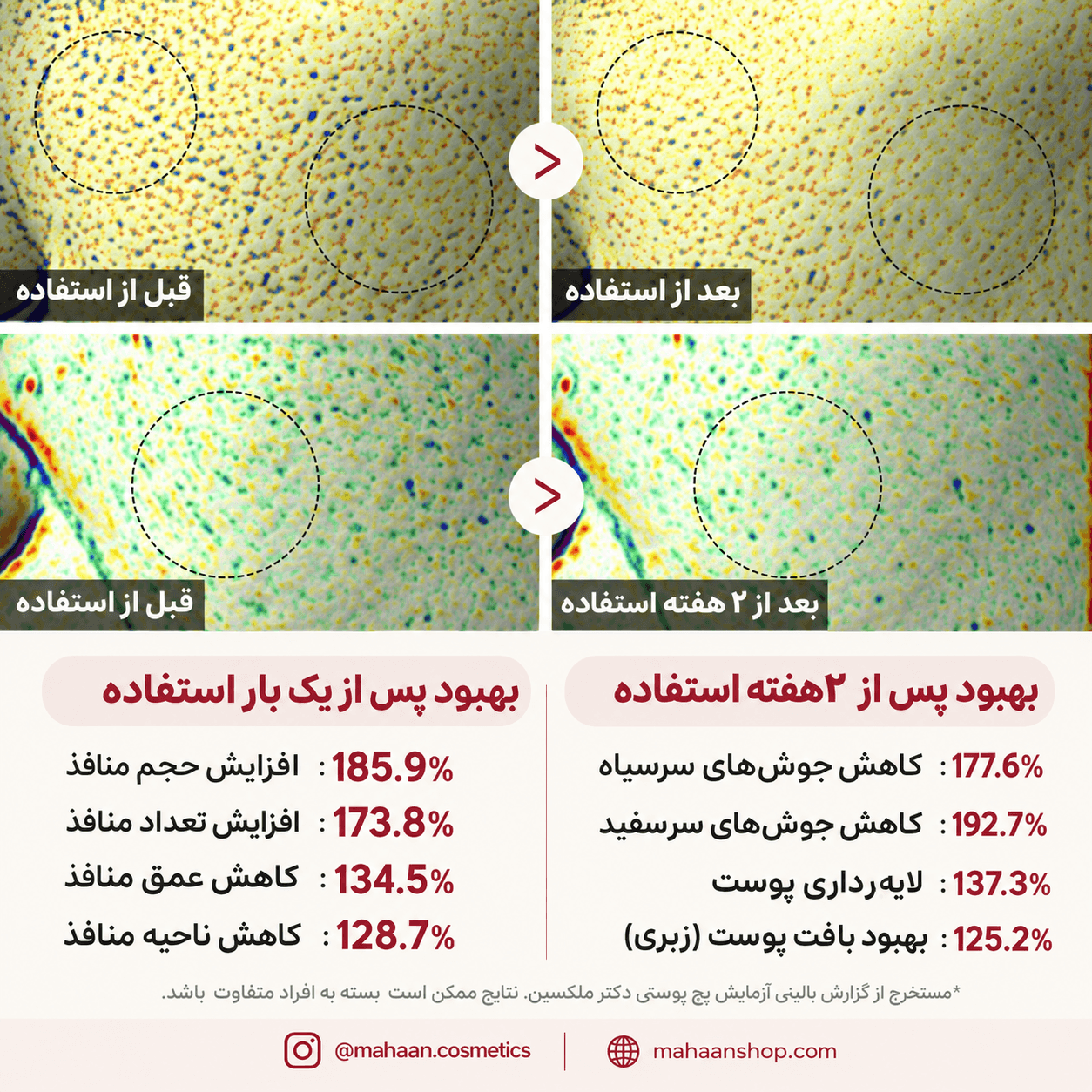 آمپول لایه بردار پیل شات برنج سفید دکتر ملاکسین | Dr.Melaxin Peel Shot Glow White Rice Ampoule — تصویر ۷