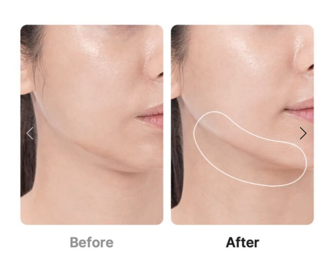 دستگاه جوانساز بوستر پرو مدی کیوب اصل کره ای صورتی و مشکی MEDICUBE AGE-R BOOSTER PRO — تصویر ۴