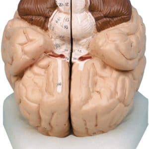 مولاژ مغز